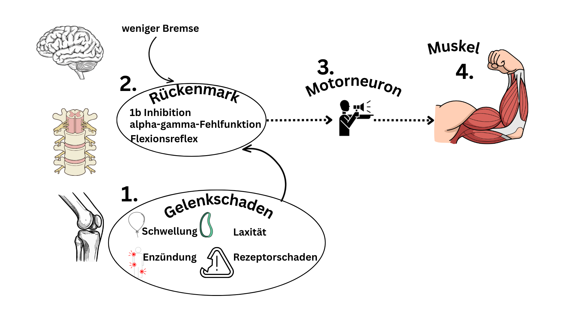 Mechanismen der Gelenkshemmung in der Physiotherapie
